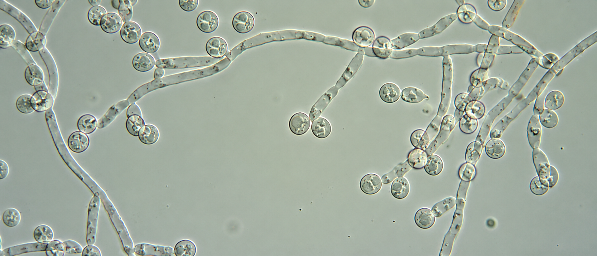 Fungi in the Gut: How Candida Influence the Gut Microbiome and Gut Flora